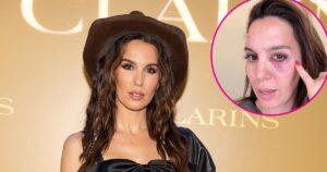 Read more about the article Christy Carlson Romano Allegedly Shot in the Eye on Husband’s Birthday