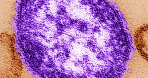 Read more about the article How to protect yourself from measles with renewed outbreaks